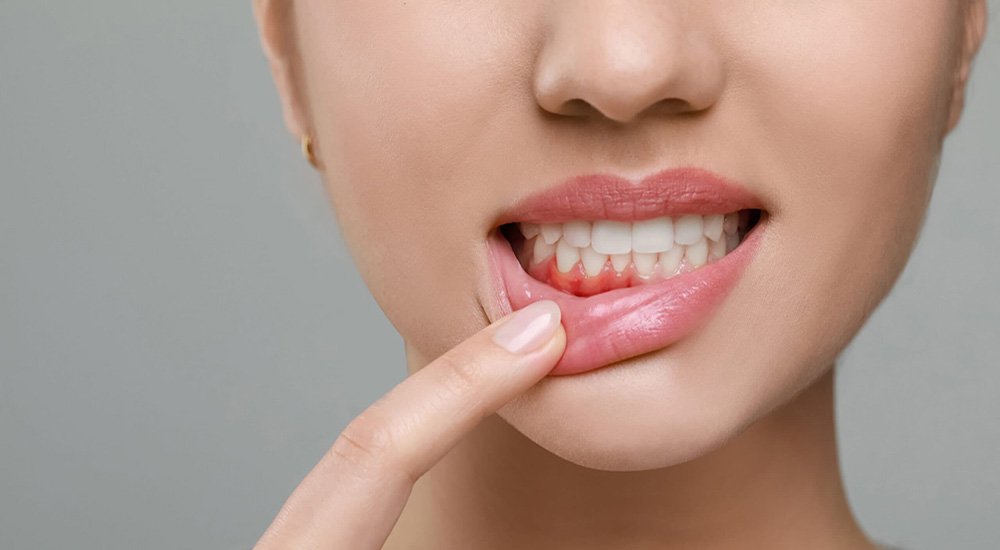 GumTreatmentsimg